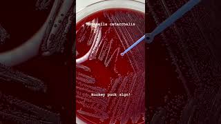 Moraxella catarrhalis Hocky Puck sign microbiology [upl. by Ariana]