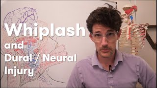 Whiplash and DuralNeural injury [upl. by Selia255]