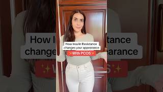 How Insulin Resistance changes your appearance with pcos [upl. by Boland]