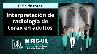 Interpretación de Radiografía de Tórax en Adultos  MIRIGUR [upl. by Trautman41]