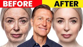 The Ultimate Face Transformation–Dr Bergs Best Remedy for Dry Skin and Wrinkles [upl. by Raffaj]