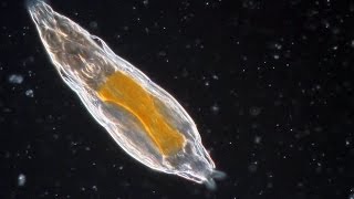 Bdelloid Rotifers so common yet so weird [upl. by Nosrak463]