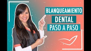 Blanqueamiento Dental Paso a Paso  Doctora Verónica [upl. by Animsaj]