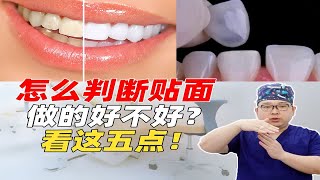 牙齿贴面做的好不好，就看这5点！你知道吗？ [upl. by Asaret]