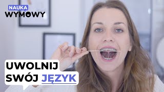 Frenotomia  jak wygląda i co dalej po podcięciu wędzidełka  Nauka Wymowy 💬 [upl. by Aliakim]