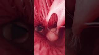 💓 Tricuspid amp Pulmonary Valves Guardians of Blood Flow 💓 anatomy [upl. by Henrieta]