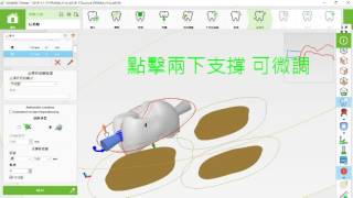 東昕WorkNC Dental 基礎操作 [upl. by Cummings]