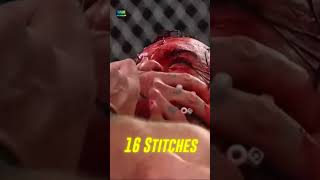 തലക്ക് 16 തുന്നൽ DrewMcIntyre cmpunk badblood injury [upl. by Annohsak819]