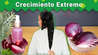 Cómo Hacer CRECER EL CABELLO con CEBOLLA🌺  Crece tu Cabello Rápido y Fácil Con Cebolla  FUNCIONA [upl. by Relyc52]