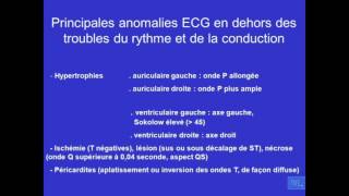 ECG normale er principales anomalies Partie 4 [upl. by Arbmahs1]