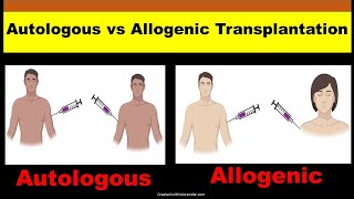 Autologous vs Allogeneic Transplant  Autologous and Allogeneic Stem Cell Transplantation [upl. by Alesiram45]