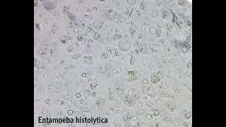 Entamoeba histolytica and trichomonas hominis [upl. by Airt]