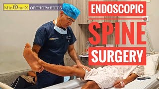 PIVD  Slipped Disc  treated by Endoscopic Spine Surgery [upl. by Ecitnirp]