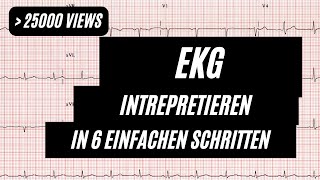 EKG interpretieren in 6 Schritten [upl. by Ephrem]