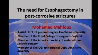 محاضرة corrosives to the esophagus دكتور محمد محفوظ ماجستير ودكتوراه طب عين شمس [upl. by Alleroif]