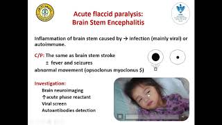 acute flaccid paralysis in children [upl. by Euqnimod]