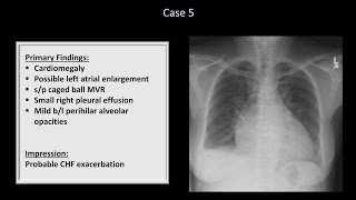 How to Interpret a Chest XRay Lesson 10  Self Assessment Part 1 [upl. by Wei681]