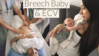 Breech Baby amp Successful ECV  Tips for Success and My Experience [upl. by Ahsotal]