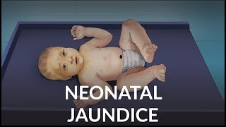 Neonatal Jaundice by L Veit  OPENPediatrics [upl. by Kobe]