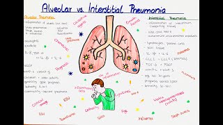 Alveolar vs Interstitial Pneumonia comparison [upl. by Nylevol152]