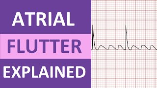 Atrial Flutter ECG Causes Treatment Nursing NCLEX ACLS Heart Rhythm Explained [upl. by Addiel485]