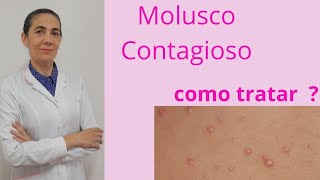 Como identificar e tratar o molusco contagioso [upl. by Ahsoyek]