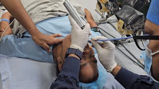 Difficult Intubation Fixationorthopedics surgery generalanesthesia malampati 3anesthesia [upl. by Alyose]