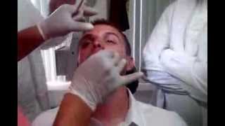 Taponamiento Nasal Posterior por Dr Eliseo Ramirez [upl. by Eceinert]