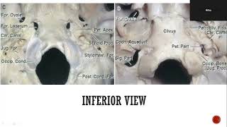 Anatomy of Jugular Foramen [upl. by Ariajay]