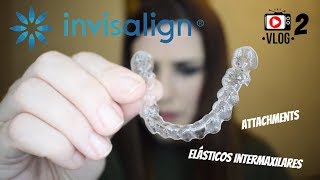 Mi segundo par de Invisalign Attachments elásticos intermaxilares botones de sujeciónVlog [upl. by Eical43]