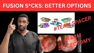 Why Spinal Fusion Scks  Should you choose Team Spacer or Team Discectomy [upl. by Hennebery]