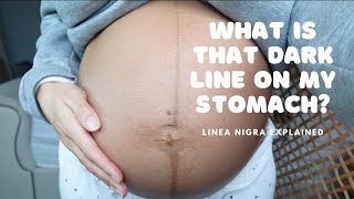 What is that dark line on my stomach in pregnancy The Linea Nigra [upl. by Moyra84]