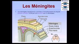 Méningite bactérienne cérébro spinale maladie infectieuse [upl. by Goldwin]