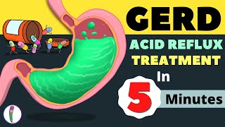 GERD Treatment  Acid Reflux Treatment  Heartburn Treatment  All You Need to Know [upl. by Nostrebor]