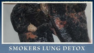 7 Steps on How to Heal and Recover Lungs from Smoking [upl. by Doroteya]