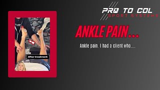 Ankle Pain even After a Sprain [upl. by Airrat]