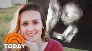 Pregnant Teen Speaks Out About Being Banned From Graduation  TODAY [upl. by Gautea]