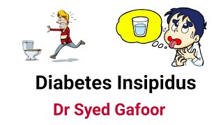 Approach To Polyuria  Diabetes Insipidus DrSyed Gafoor [upl. by Katy487]