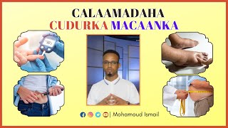 Calaamadaha Cudurka MacaankaSonkorwga [upl. by Ernie]