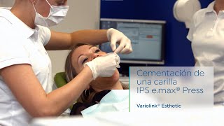 Variolink® Esthetic LC  Cementación de una carilla IPS emax® Press [upl. by Stacey178]