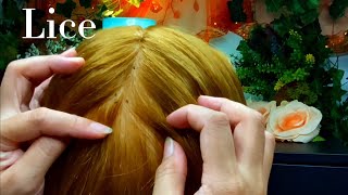 ASMR Lice Removal Pop the Lice directly on the Scalp and nails 😴💤🥱 [upl. by Rosaline22]