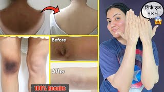 Dark Neck Elbow Knee Back Full Body Tan कालेपन को जड़ से खत्म करें सिर्फ 1 बार में ❤️ [upl. by Egduj595]