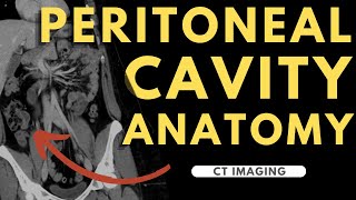 Peritoneal cavity abdominal organs and spaces  Radiology anatomy part 1 prep  CT abdomen [upl. by Pulcheria]