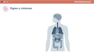 Hemoglobinuria paroxística nocturna hablemos de una patología no frecuente [upl. by Audrye]