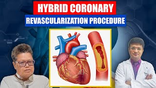 Hybrid Coronary Revascularization Procedure [upl. by Tiffanle436]