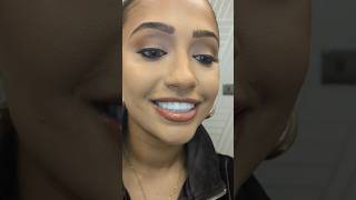 Before and after a full set of composite veneers veneers newsmile teethwhitening howto hack [upl. by Nage128]