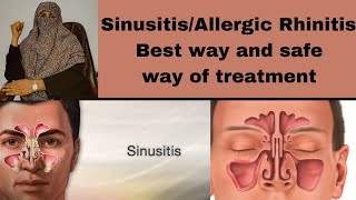 sinusitis treatment medicine for allergic RhinitisNostrits pain treatment [upl. by Alrak740]