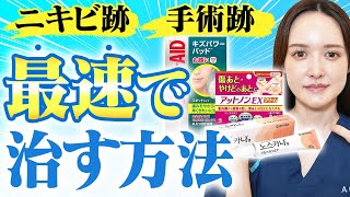 【ニキビ跡・傷跡ケア】整形を繰り返した美容外科医が一番効果のあった傷跡ケアを教えます [upl. by Kimberley]