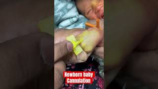 New born baby cannulation ivcannulation mbbs ivinsertion SMpharmacy subscribe [upl. by Nastassia439]