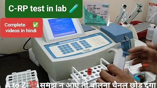 CRP testCREACTIVE PROTEINCRP test in hindi procedure CRPlabmltlabpathologylaboratoryblood [upl. by Dehsar]